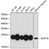 Anti-HSPC111 antibody used in Western Blot (WB). GTX66197