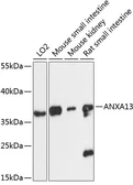 Anti-Annexin A13 antibody used in Western Blot (WB). GTX66200