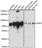 Anti-Lysyl-tRNA synthetase antibody used in Western Blot (WB). GTX66204