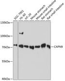 Anti-Calpain 9 antibody used in Western Blot (WB). GTX66207
