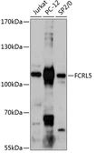 Anti-FcRH5 antibody used in Western Blot (WB). GTX66209