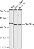 Anti-EFCAB4B antibody used in Western Blot (WB). GTX66215