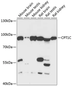 Anti-CPT1C antibody used in Western Blot (WB). GTX66217