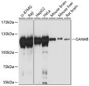 Anti-alpha Glucosidase II antibody used in Western Blot (WB). GTX66218