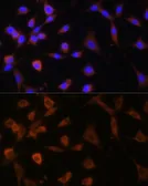 Anti-alpha Glucosidase II antibody used in Immunocytochemistry/ Immunofluorescence (ICC/IF). GTX66218