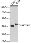Anti-HOXA13 antibody used in Western Blot (WB). GTX66227