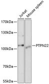 Anti-PTPN22 antibody used in Western Blot (WB). GTX66229
