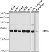 Anti-HSPC111 antibody used in Western Blot (WB). GTX66230