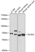 Anti-SLC6A2 antibody used in Western Blot (WB). GTX66236