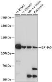 Anti-EphA5 antibody used in Western Blot (WB). GTX66237