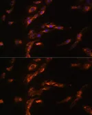 Anti-GABA A Receptor gamma 1 antibody used in Immunocytochemistry/ Immunofluorescence (ICC/IF). GTX66238