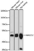 Anti-HMGCS2 antibody used in Western Blot (WB). GTX66240