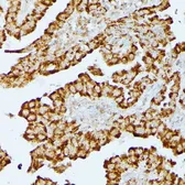 Anti-HMGCS2 antibody used in IHC (Paraffin sections) (IHC-P). GTX66240