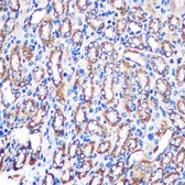 Anti-NDUFA4L2 antibody used in IHC (Paraffin sections) (IHC-P). GTX66244