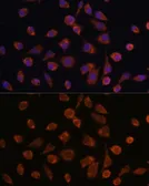 Anti-Mimitin antibody used in Immunocytochemistry/ Immunofluorescence (ICC/IF). GTX66245