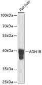 Anti-Alcohol dehydrogenase 1B antibody used in Western Blot (WB). GTX66246