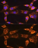Anti-RABL3 antibody used in Immunocytochemistry/ Immunofluorescence (ICC/IF). GTX66249