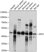 Anti-ZNF2 antibody used in Western Blot (WB). GTX66254