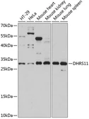 Anti-DHRS11 antibody used in Western Blot (WB). GTX66257
