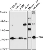 Anti-Thyrotropin releasing hormone antibody used in Western Blot (WB). GTX66259
