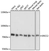 Anti-XPD antibody used in Western Blot (WB). GTX66267