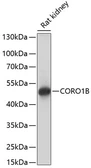 Anti-Coronin 1B antibody used in Western Blot (WB). GTX66270