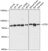 Anti-LZTS2 antibody used in Western Blot (WB). GTX66271
