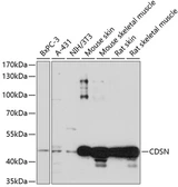 Anti-Corneodesmosin antibody used in Western Blot (WB). GTX66273