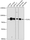 Anti-Factor XIIIa antibody used in Western Blot (WB). GTX66274