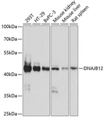 Anti-DNAJB12 antibody used in Western Blot (WB). GTX66277