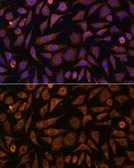 Anti-Rab 1A antibody used in Immunocytochemistry/ Immunofluorescence (ICC/IF). GTX66279