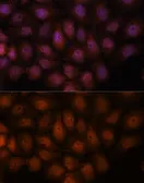 Anti-Importin 8 antibody used in Immunocytochemistry/ Immunofluorescence (ICC/IF). GTX66280
