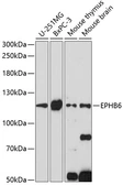 Anti-EphB6 antibody used in Western Blot (WB). GTX66283