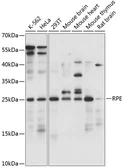 Anti-RPE antibody used in Western Blot (WB). GTX66288