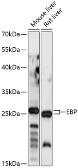 Anti-EBP antibody used in Western Blot (WB). GTX66299