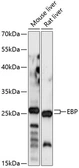 Anti-EBP antibody used in Western Blot (WB). GTX66299