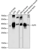 Anti-C17orf81 antibody used in Western Blot (WB). GTX66300