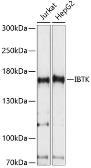 Anti-IBTK antibody used in Western Blot (WB). GTX66301