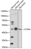 Anti-PSCD4 antibody used in Western Blot (WB). GTX66303