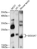 Anti-GOLGA7 antibody used in Western Blot (WB). GTX66306