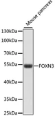 Anti-CHES1 antibody used in Western Blot (WB). GTX66322