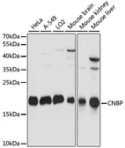 Anti-CNBP antibody used in Western Blot (WB). GTX66334