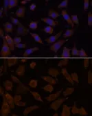 Anti-OXSR1 antibody used in Immunocytochemistry/ Immunofluorescence (ICC/IF). GTX66335