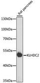 Anti-KLHDC2 antibody used in Western Blot (WB). GTX66338