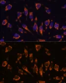 Anti-CRELD1 antibody used in Immunocytochemistry/ Immunofluorescence (ICC/IF). GTX66342