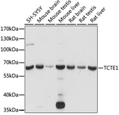 Anti-TCTE1 antibody used in Western Blot (WB). GTX66345
