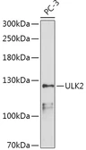 Anti-ULK2 antibody used in Western Blot (WB). GTX66347