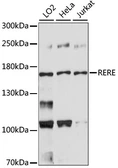 Anti-RERE antibody used in Western Blot (WB). GTX66349