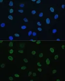 Anti-GTF2E1 antibody used in Immunocytochemistry/ Immunofluorescence (ICC/IF). GTX66351