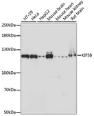 Anti-KIF5B antibody used in Western Blot (WB). GTX66352